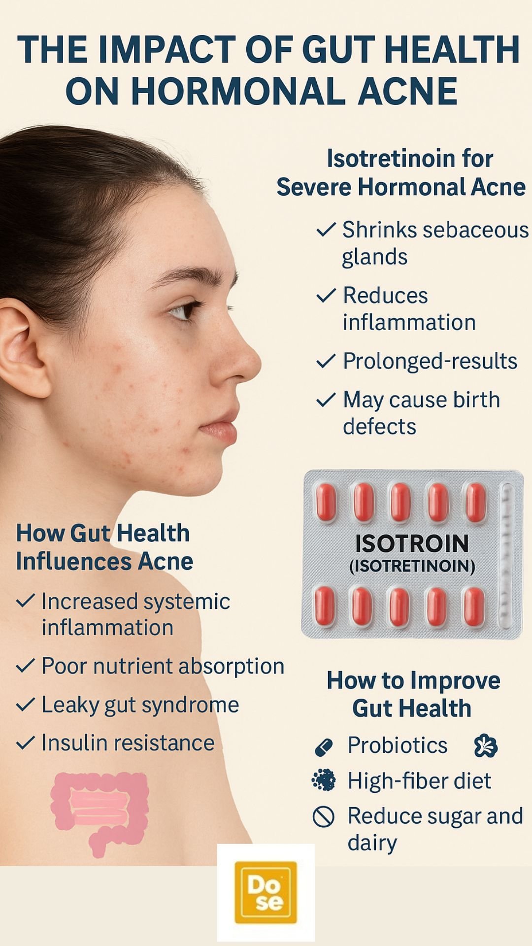 The impact of gut health on hormonal acne