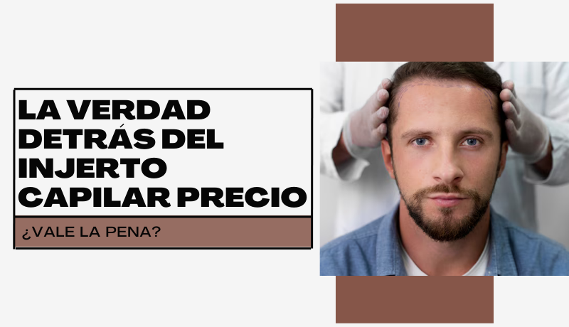 La verdad detrás del injerto capilar precio: ¿Vale la pena?